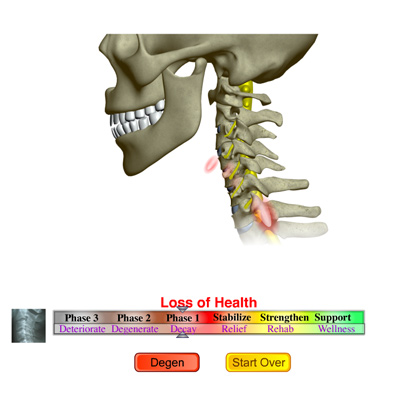 Chiropractic Patient Education