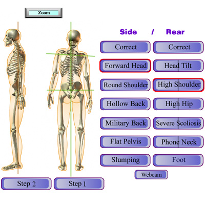 Chiropractic Patient Education